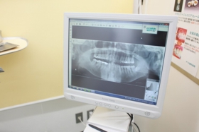 被曝量が少なく体にやさしいデジタルレントゲン